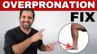 4 Exercises To Correct Overpronation In Runners To Prevent Injury [upl. by Aivilo]