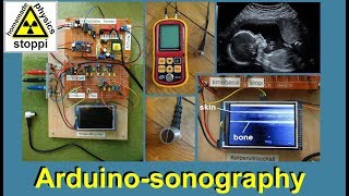 ultrasonic body sonography with arduino  part 2 [upl. by Rania]