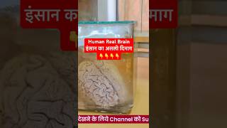 Human Real Brain viral shorts [upl. by Ahsenod]