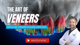 Making Porcelain Veneers  The Art of Veneers [upl. by Ysdnyl843]