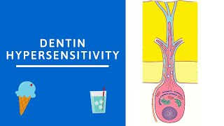 Dentin hypersensitivity Dentin Pulp Complex Session 8 [upl. by Eenaffit]