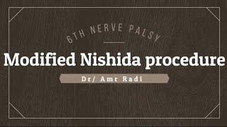 Modified Nishida procedure for 6th nerve palsy [upl. by Carl]