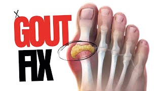 Gout Relief Natural Solution [upl. by Asirrom510]