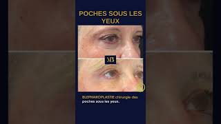 Comment camoufler ses poches sous les yeux de façon très naturelle [upl. by Mendez]