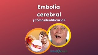 ¿QUÉ ES UNA EMBOLIA CEREBRAL [upl. by Acimat857]