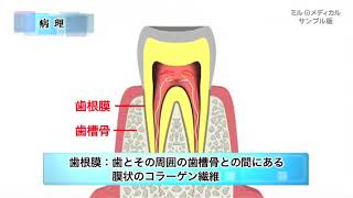 歯根膜炎／ミルメディカル 家庭の医学 動画版 [upl. by Swerdna600]