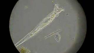 The Happy Rotifer [upl. by Rol]