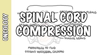 Spinal Cord Compression  medical emergency causes symptoms diagnosis treatment [upl. by Dunkin]