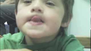 Dariens Journey with Childhood Apraxia of Speech [upl. by Neerom]