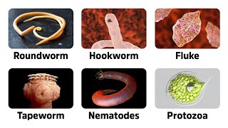 9 Warning Signs of Parasites [upl. by Eitsirk750]