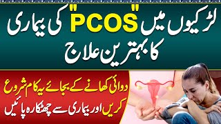 PCOS Treatment Symptoms and Diet  PCOS Diet Plan  Hormonal Imbalance Treatment  PCOS Ka Ilaj [upl. by Ward274]