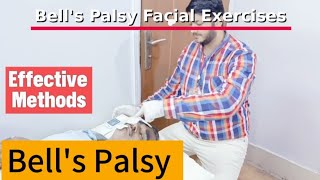 Bells Palsy Treatment Effective Facial Exercise Rehabilitation Methods [upl. by Taryn584]