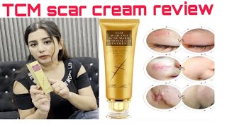 TCM scar removal cream review scartreatment [upl. by Aklog]