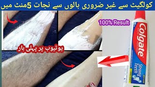 INSTANTLY REMOVE UNWANTED HAIR No WaxNo THREADING in UrduHindi [upl. by Tammi]