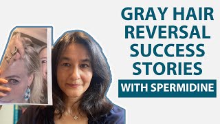 Gray Hair Reversal Success Stories with Spermidine [upl. by Atihana]