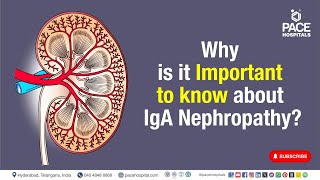 IgA Nephropathy Important  Why is it Important to know about IgA Nephropathy  iganephropathy [upl. by Esinyt]