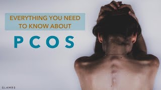 Everything You Need To Know About PCOS  Causes Symptoms Treatments [upl. by Popele]