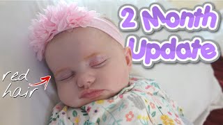 Reflux amp Milk Allergy  2 MONTH BABY UPDATE [upl. by Nicolai]