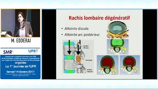 IRM du rachis lombaire pour le rhumatologue Pr M EDDERAI [upl. by Horbal]