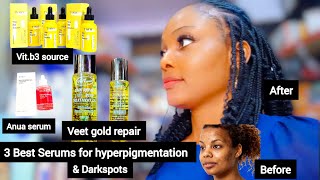 BEST FACE SERUMS FOR A GLOWING SKIN HOW TO CLEAR HYPERPIGMENTATION QUICKLY  FACE amp BODY TREATMENT [upl. by Aneladdam636]