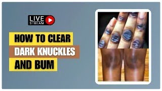 Esthetician Shares Simple Tricks to Brighten Knuckles and Knees [upl. by Notsej]