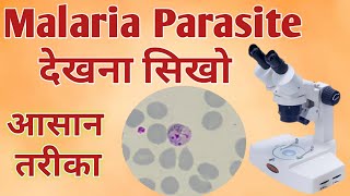 Malaria parasite under microscope  Malaria test  Malaria test procedure [upl. by Stefania520]