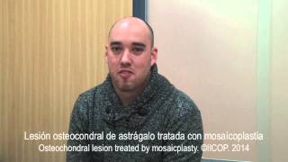 TESTIMONIO PACIENTE OPERADO DE OSTEOCONDRITIS DE ASTRAGALO [upl. by Bartholemy988]