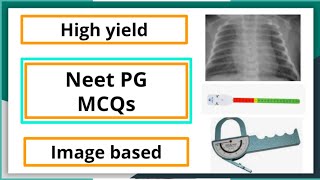 Neet Pg MCQ Pediatric subject high yield mbbs neetpgpreperation pediaticlectureformedicalstudent [upl. by Ilona]