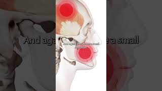 Temporalis Muscle Trigger Points [upl. by Hugo]