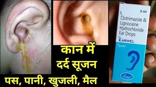 Earwel Ear Drops uses side effects in hindi earwel ear drop use hindi [upl. by Eikceb]