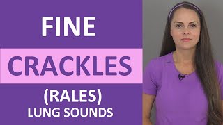 Fine Crackles Rales Lung Sound Causes Breath Sounds Audio Nursing [upl. by Norina]