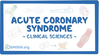 Acute coronary syndrome Clinical sciences [upl. by Barvick]