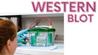 Western blot  Western blotting technique explained [upl. by Ennasil]