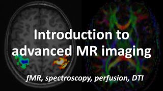 An Introduction to Advanced MRI techniques fMRI spectroscopy perfusion amp diffusion tensor imaging [upl. by Girhiny]