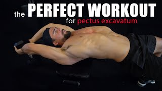 The Perfect Workout Routine to Improve Pectus Excavatum [upl. by Morice]