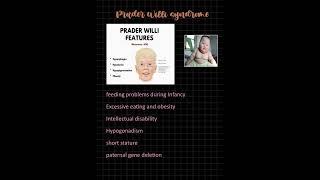 PRADER WILLI SYNDROME MNEMONIC fmge study MBBS [upl. by Procto]