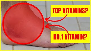 Top Vitamins to Reduce Swollen Legs and Feet  No1 vitamin for removing leg and foot SWELLING [upl. by Elleirbag]