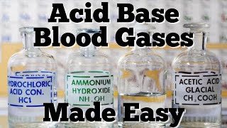 Acid Base Mnemonic for Anion Gap Metabolic Acidosis Quick amp EZ Episode 14 [upl. by Aihsena865]