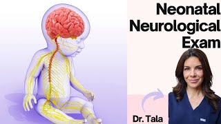 How to perform the NEURO exam on a baby HeadtoToe CNS evaluation [upl. by Lateh]