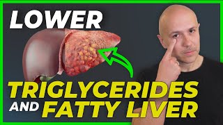 LOWER your TRIGLYCERIDES and FATTY LIVER  NO MEDS  DR CARLOS [upl. by Suoicerp]