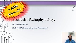 Psoriasis  Pathophysiology [upl. by Abeu]