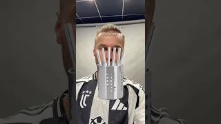 Koop is unlucky 😭 juventus [upl. by Cirde]