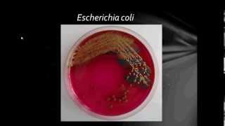 Bacteriology Gram Negative Bacilli Part1 [upl. by Nerta]