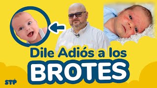 CUIDADO CON BROTES EN RECIEN NACIDOS  SoyTuPediatra [upl. by Graeme]