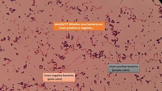 Gram positive and Gram negative bacterial slides under the Microscope [upl. by Lynden]