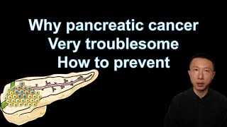 Understanding Pancreatic Cancer Symptoms Risks and Prevention Tips  Expert Insights [upl. by Zarla]