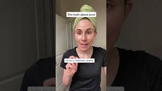 The truth about hormonal acne dermatologist DrDrayzday [upl. by Rehm724]