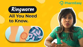 Treatment for Ringworm and Fungal Infection  Dr Soma Sarkar PharmEasy [upl. by Nisbet]