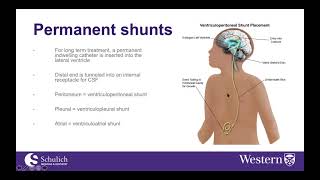 Anesthesia for CSF shunting procedures [upl. by Wehtta35]