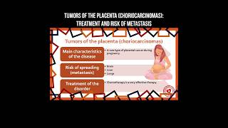 The tumors of placenta choriocarcinoma treatment and risk of metastasis tumor placenta cancer [upl. by Nrehtak769]